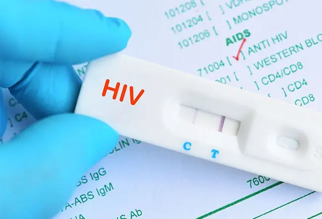 HIV Symptoms You Need to Be Aware of __ Life Aid